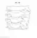Fig. 33 - Intervertebral disc and insertion methods therefor