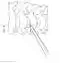 Fig. 37 - Intervertebral disc and insertion methods therefor