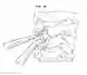 Fig. 40 - Intervertebral disc and insertion methods therefor
