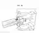 Fig. 44 - Intervertebral disc and insertion methods therefor