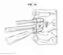 Fig. 45 - Intervertebral disc and insertion methods therefor