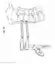 Fig. 48 - Intervertebral disc and insertion methods therefor