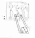 Fig. 62 - Intervertebral disc and insertion methods therefor