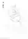 Fig. 03 - Acetabular implant alignment devices and methods