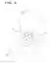 Fig. 06 - Acetabular implant alignment devices and methods