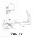 Fig. 13 - Acetabular implant alignment devices and methods