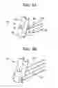 Fig. 03 - Minimally invasive intervertebral staple distraction devices
