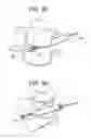 Fig. 06 - Minimally invasive intervertebral staple distraction devices