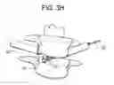 Fig. 07 - Minimally invasive intervertebral staple distraction devices