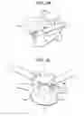 Fig. 09 - Minimally invasive intervertebral staple distraction devices