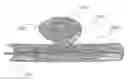 Fig. 01 - HEAT-TREATED BRAIDED INTRAVASCULAR DEVICES AND METHODS