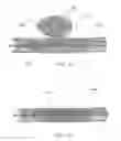 Fig. 15 - HEAT-TREATED BRAIDED INTRAVASCULAR DEVICES AND METHODS