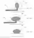Fig. 16 - HEAT-TREATED BRAIDED INTRAVASCULAR DEVICES AND METHODS