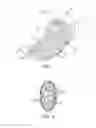 Fig. 02 - DEVICES AND SYSTEMS FOR GASTRIC VOLUME CONTROL
