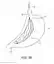 Fig. 07 - DEVICES AND SYSTEMS FOR GASTRIC VOLUME CONTROL