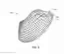 Fig. 08 - DEVICES AND SYSTEMS FOR GASTRIC VOLUME CONTROL