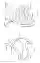 Fig. 02 - Methods allowing pyloric sphincter to normally function for bariatric stents