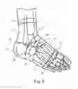 Fig. 05 - Compression foot garment, and therapeutic method for reducing heel pain
