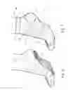Fig. 06 - Compression foot garment, and therapeutic method for reducing heel pain