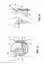 Fig. 11 - Adjustable lordosis orthopedic insert for a back brace