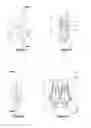 Fig. 04 - ANTI-SNORE NASAL MODULATOR