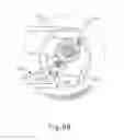 Fig. 11 - Therapeutic agent delivery device
