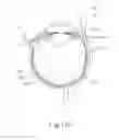 Fig. 24 - Therapeutic agent delivery device