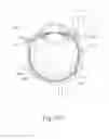 Fig. 25 - Therapeutic agent delivery device