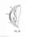 Fig. 09 - Method of altering the refractive properties of an eye