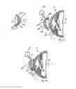Fig. 10 - Method of altering the refractive properties of an eye
