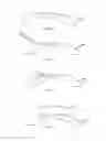 Fig. 15 - Method of altering the refractive properties of an eye