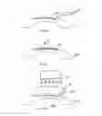 Fig. 17 - Method of altering the refractive properties of an eye