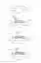 Fig. 27 - Method of altering the refractive properties of an eye