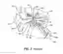 Fig. 04 - Low profile eustachian tube dilation system