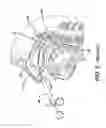 Fig. 06 - Low profile eustachian tube dilation system