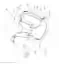 Fig. 24 - Adaptive arm support systems and methods for use
