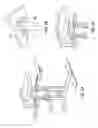 Fig. 03 - SPINAL TRACTION APPARATUS AND METHOD