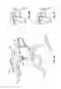 Fig. 07 - SPINAL TRACTION APPARATUS AND METHOD