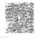 Fig. 08 - Multicomponent oral care composition