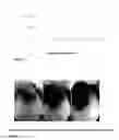 Fig. 03 - COMPOSITIONS AND METHODS FOR HAIR GROWTH