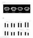 Fig. 09 - Composition Comprising AMD3100 For Preventing or Treating Bone Diseases