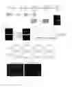 Fig. 02 - METHODS, COMPOSITIONS AND KITS FOR PROMOTING MOTOR NEURON SURVIVAL AND TREATING AND DIAGNOSING NEURODEGENERATIVE DISORDERS