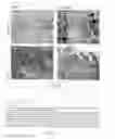 Fig. 07 - Immunomodulating gene therapy