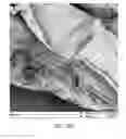 Fig. 30 - COMPOSITION, PREPARATION, AND USE OF CHITOSAN POWDER FOR BIOMEDICAL APPLICATIONS