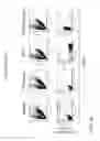 Fig. 15 - Engineering and delivery of therapeutic compositions of freshly isolated cells