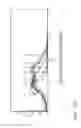 Fig. 34 - Engineering and delivery of therapeutic compositions of freshly isolated cells