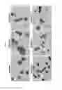 Fig. 03 - In vitro production of red blood cells with proteins comprising sortase recognition motifs