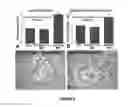 Fig. 04 - METHODS, SYSTEMS, AND COMPOSITIONS RELATING TO  TREATMENT OF NEUROLOGICAL CONDITIONS, DISEASES, AND INJURIES AND COMPLICATIONS FROM DIABETES