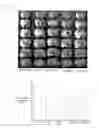 Fig. 02 - COMPOSITION FOR PREVENTING OR TREATING STROKE OR DEGENERATIVE BRAIN DISEASE
