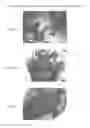 Fig. 08 - Beta-turn peptidomimetic cyclic compounds for treating dry eye